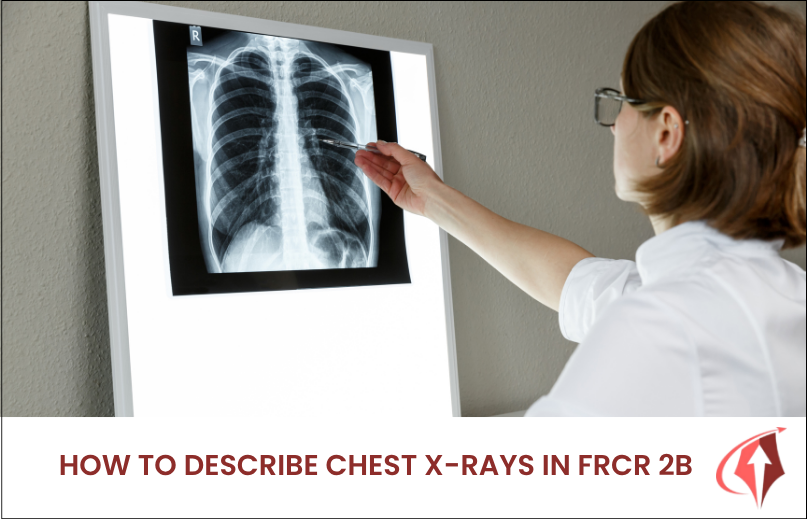 How to Describe Chest X-rays in FRCR 2B Exam