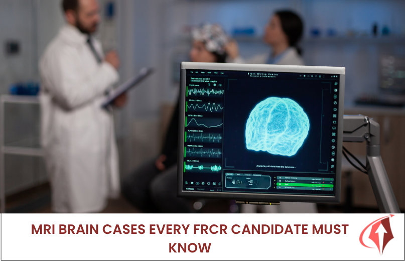 MRI Brain Cases Every FRCR Candidate Must Know